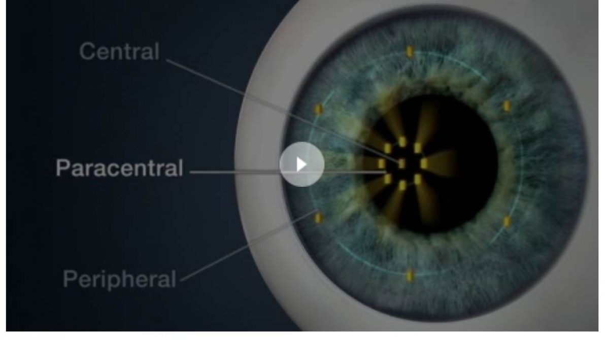 Optical Biometer AL-Scan video